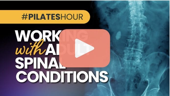 Working with Adult Spinal Deformities